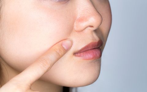 ¿Cómo disimular las arrugas nasogenianas?